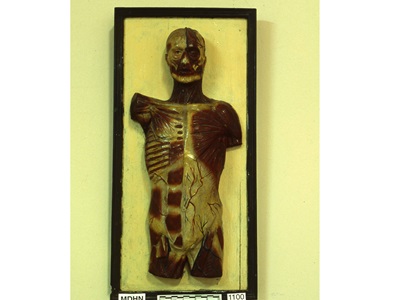 Restauració de plafons d'anatomia humana (Col·lecció Darder). Abans i després de restaurar.-2