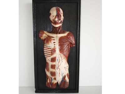 Restauració de plafons d'anatomia humana (Col·lecció Darder). Abans i després de restaurar.-3