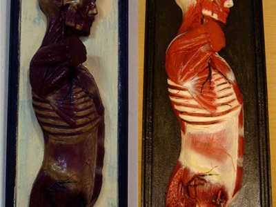 Restauració de plafons d'anatomia humana (Col·lecció Darder). Abans i després de restaurar.-6
