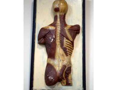 Restauració de plafons d'anatomia humana (Col·lecció Darder). Abans i després de restaurar.-4
