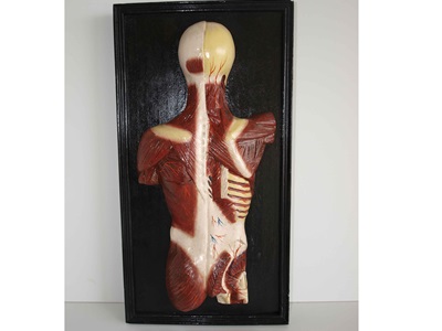 Restauració de plafons d'anatomia humana (Col·lecció Darder). Abans i després de restaurar.-5