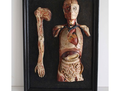 Restauració de plafons d'anatomia humana (Col·lecció Darder). Abans i després de restaurar.-7