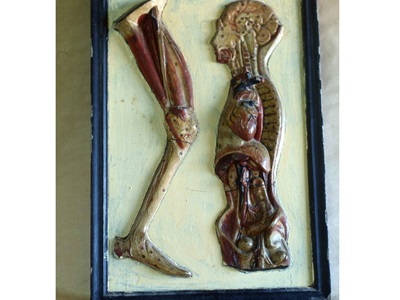 Restauració de plafons d'anatomia humana (Col·lecció Darder). Abans i després de restaurar.-8