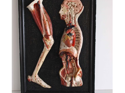Restauració de plafons d'anatomia humana (Col·lecció Darder). Abans i després de restaurar.-9
