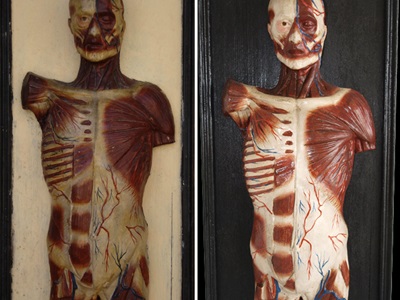 Un dels models anatòmics de la Col·lecció Darder, abans i després de restaurar.